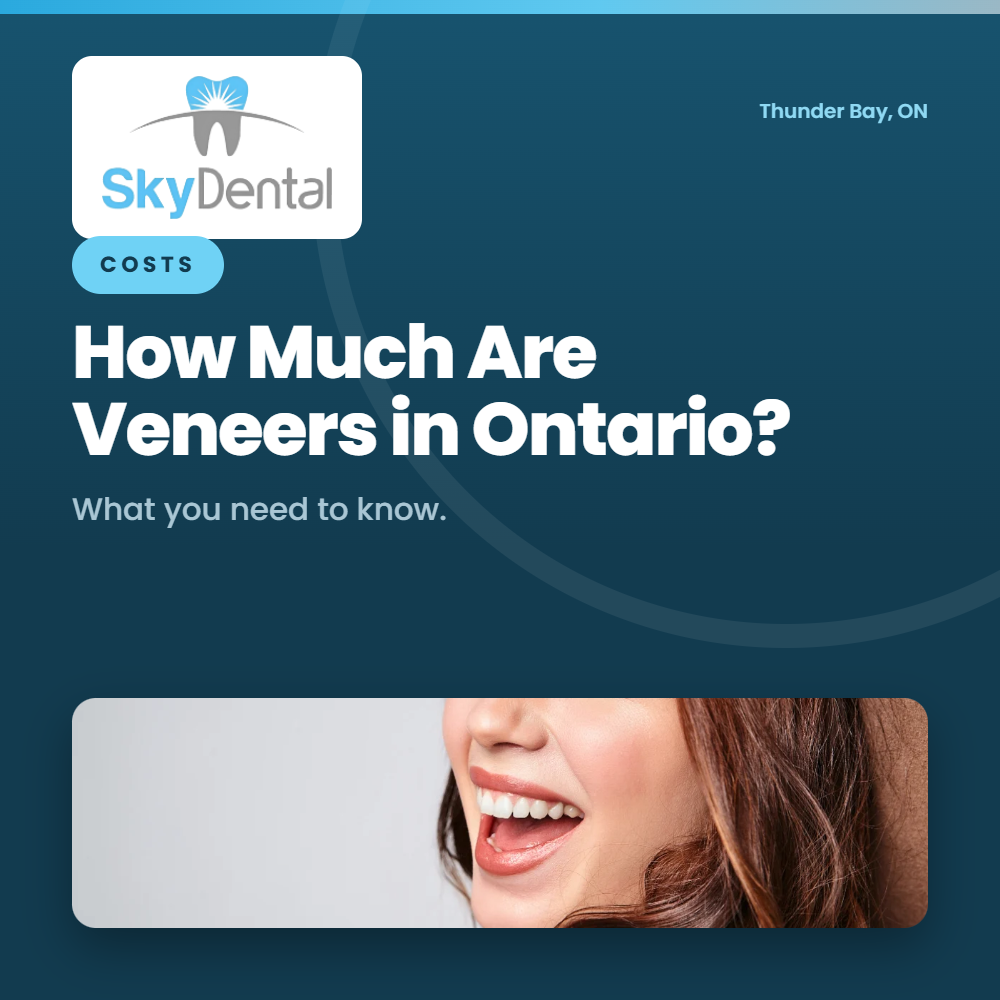 Close-up of a woman's smiling mouth and long hair, SkyDental Costs blog cover: How Much Are Veneers in Ontario? – what you need to know.