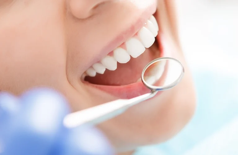 How Long Do Dental Crowns Last