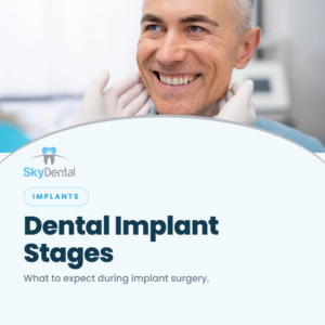 Smiling middle-aged man with a dentist's gloved hands near his jaw, SkyDental Implants blog cover: Dental Implant Stages – what to expect during implant surgery.