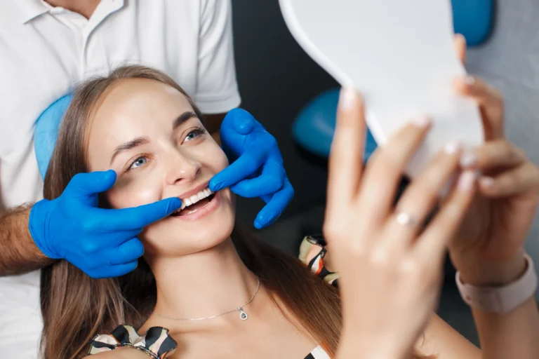 veneers
