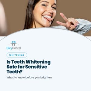 Is Teeth Whitening Safe for Sensitive Teeth?