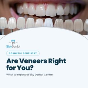 a patient smiling choosing a veneers