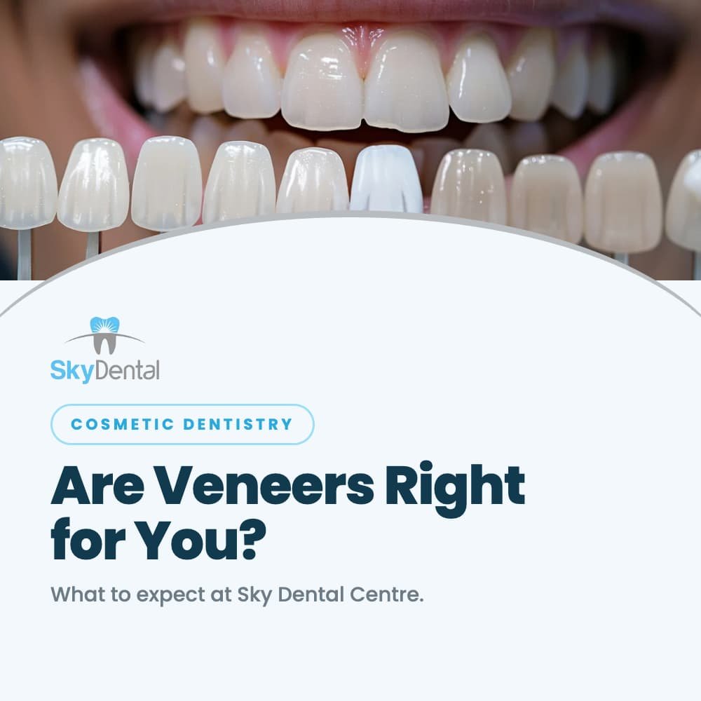 a patient smiling choosing a veneers